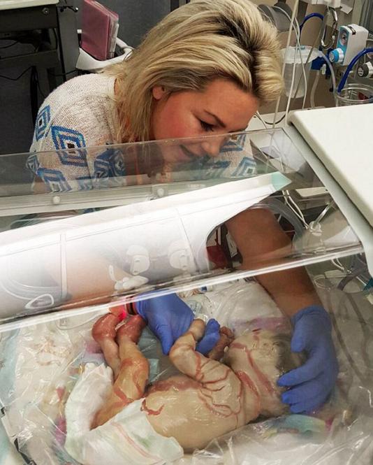 婴幼儿脖子花斑癣多久可以痊愈,婴儿花斑癣怎样算治好了