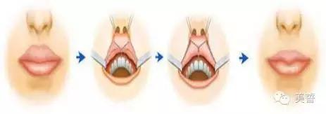 唇唇欲动攻略,唇部拯救你的唇形