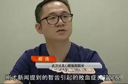 下面的智齿拔了上面的可以不拔吗,下智齿只拔了一侧另一侧不拔行吗