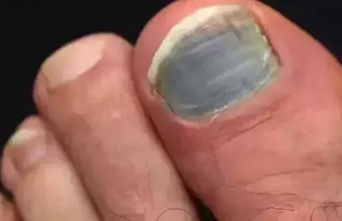 98跑,98跑步是啥意思