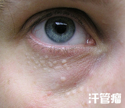 星星眼的小技巧,如何轻松get星星眼