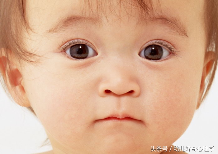 宝宝爱眨眼睛爱挤眼睛怎么办,孩子老眨眼眼睛睁不大