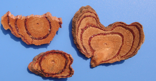 咸阳腰椎间盘突出治疗偏方,治疗颈椎病腰间盘突出等的方法