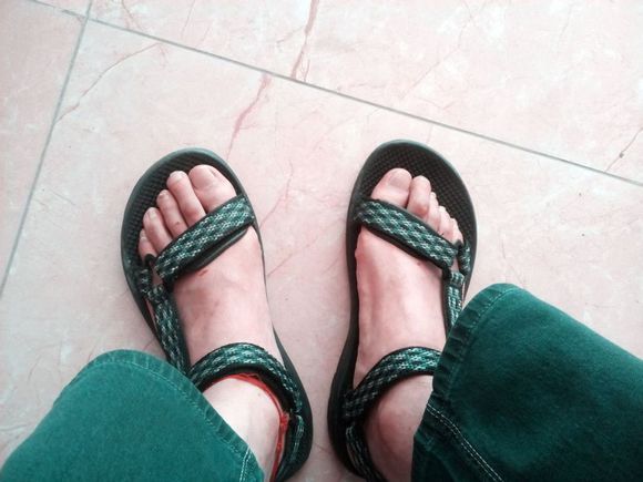 手汗多，脚汗多，1个外洗古方屡屡有效