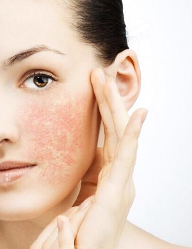 皮肤角质层薄脸发红用什么药修复,脸上有红血丝角质层薄怎么修复