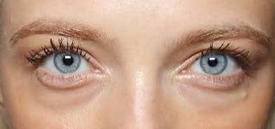 40岁眼周适合用什么样的眼霜,眼周发黑适合用什么眼霜