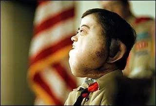 这个十四岁男孩，决定切掉自己的左脸