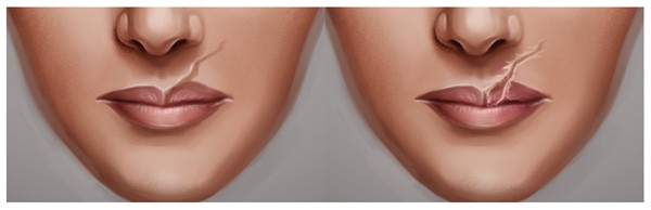 脸上疤痕绘画教程,怎么画雀斑p图