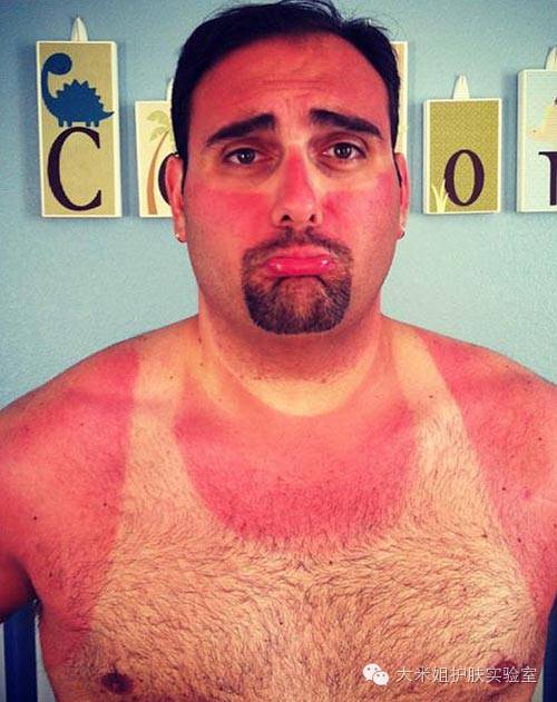 美白祛斑真的有科学依据吗,美白祛斑的原理