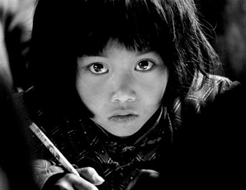 白眼球突然红了一大块怎么办,白眼球突然更白了是咋回事