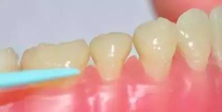 前牙有缝有什么说法吗,前牙有洞怎么补救