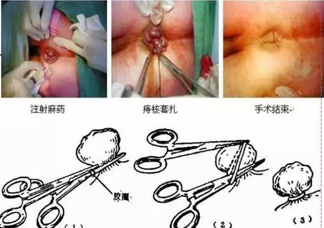 过了嘴瘾，上面舒服下面受折磨怎么破？