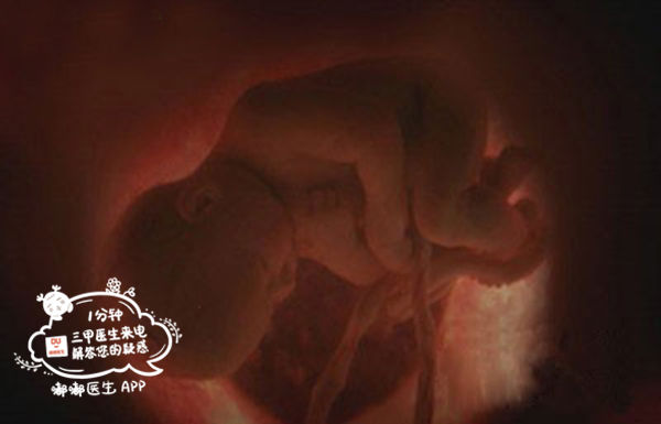 二胎不产检危险,二胎不做产检怎么样