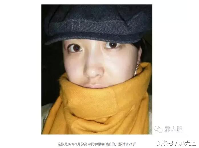 当你以为抗老还要靠超声刀的时候，我去打了更牛X的热拉提