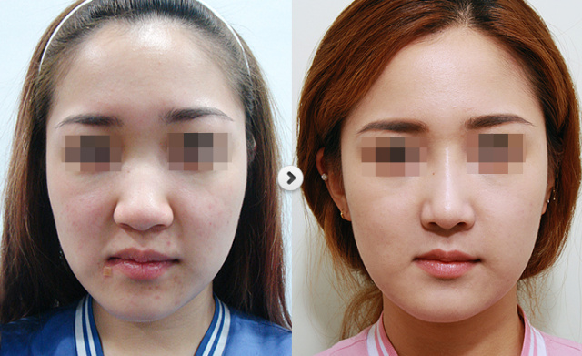 大鼻子不好看咋办,大鼻子好看还是小鼻子好看