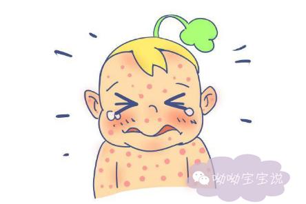 孩子生疹子有什么症状怎么治疗,八个月宝宝发烧是起疹子症状吗