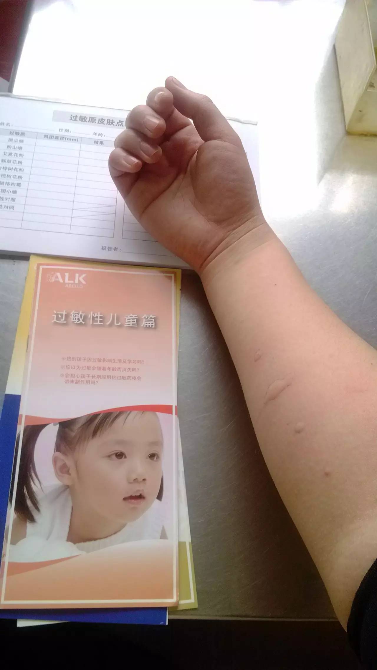 张景明讲小儿哮喘治疗方法,曲教授讲哮喘病如何治疗