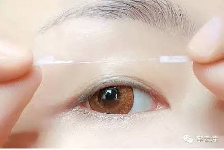 双眼皮18天消肿方法,贴双眼皮教程三眼皮