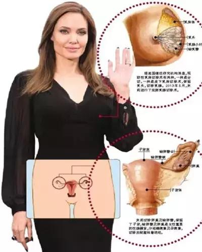 16岁女孩癌,15岁卵巢癌症状