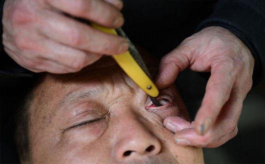 总感觉眼睛有点辣是怎么回事,总感觉眼睛又酸又干涩是什么原因