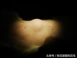 长了脂肪瘤有几种方法去掉,长了脂肪瘤怎么去除