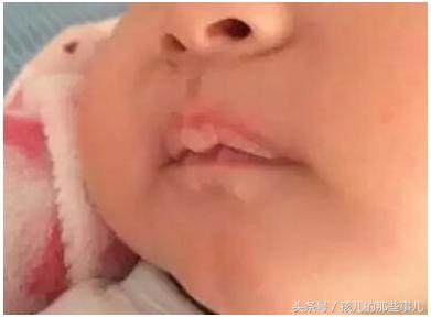 春天容易上火应该怎样预防,宝宝上火的症状和预防措施