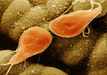 深圳男子被食脑虫入侵死亡,深圳男子被罕见食脑虫入侵