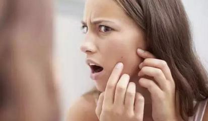 全身长痘是什么原因引起的,下巴反复长痘痘是什么原因