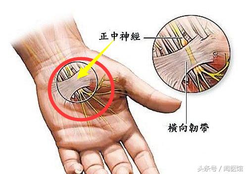 跟着练：握紧拳头，再松开，出现握拳无力、手抖晃动真要注意了
