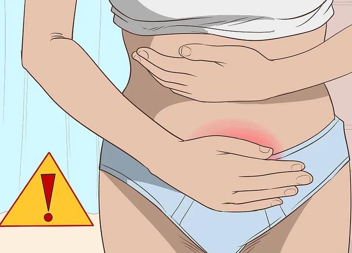 念珠菌性阴道炎的白带是怎么样的,念珠菌性阴道炎白带流出怎么回事