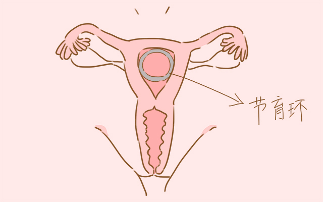 为什么外国女人很少,国外女性长期避孕