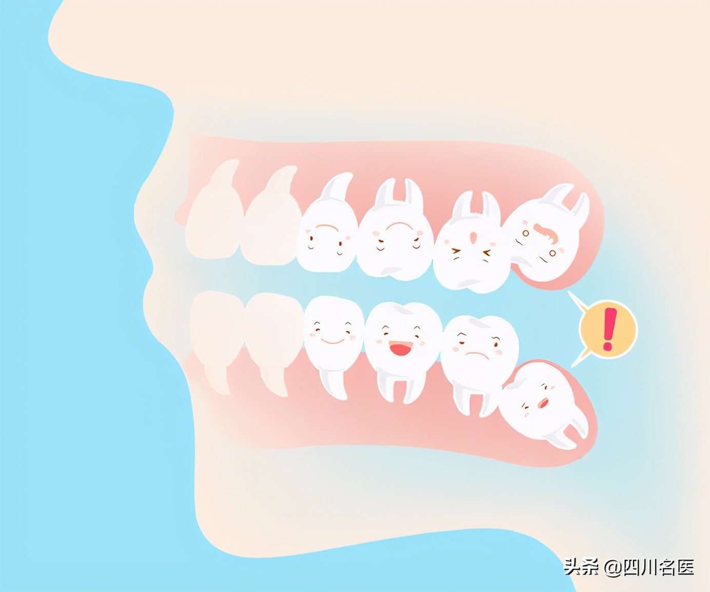 智齿一次拔几颗合适,智齿一定要拔吗几岁拔