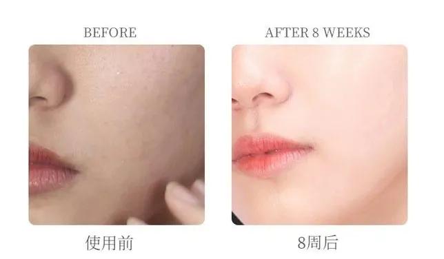 抗初老面膜平价推荐,抗初老补水面膜