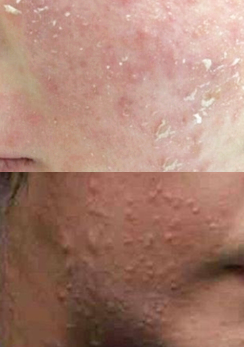 张韶涵坚持用护肤油5年，宋轶直接把油涂全身，难怪皮肤嫩出水