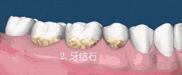 牙齿开瓶盖是嫌它太硬吗?牙齿使用说明书,简直太绝了