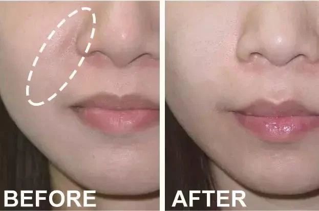 杨紫近照曝光无修图法令纹很深,杨紫面部填充法令纹