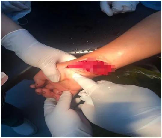 7小时手术拯救12岁少年割断肌腱，疫情之下，许你未来