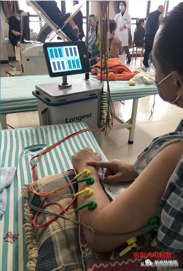 偏瘫和疼痛的物理治疗选择