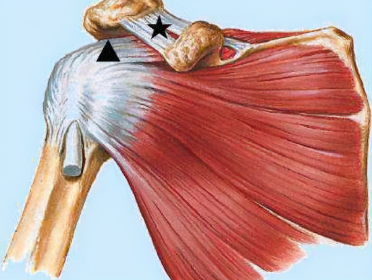 拜拜肉和肩胛骨的关系,拜拜肉一直减不掉怎么办