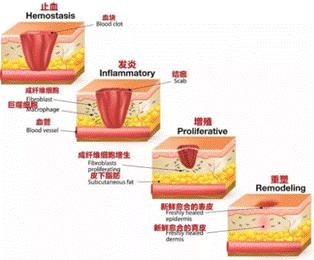 如果是剖腹产疤痕体质怎么办,剖腹产难看的疤痕教你轻松美化