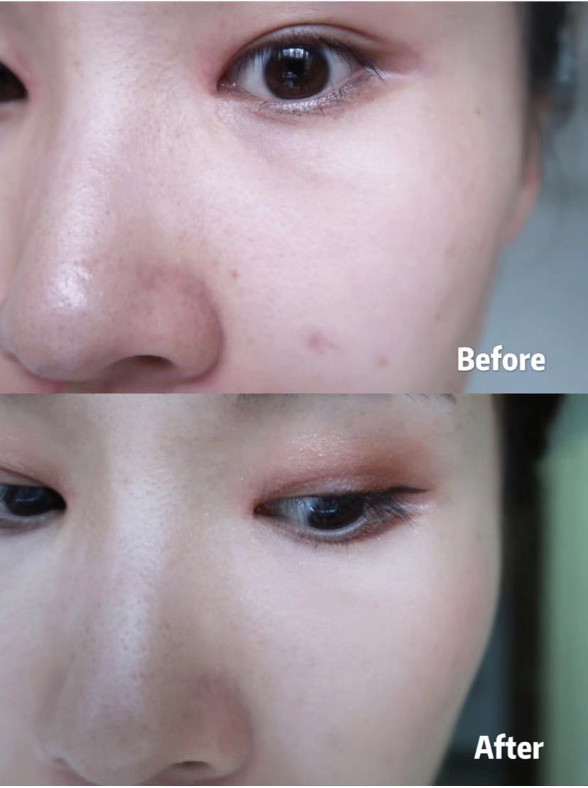 和肌肤问题说再见,可以遮脸的遮瑕推荐