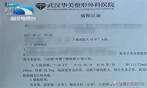 女孩变美做削骨手术,女子削骨全身整容