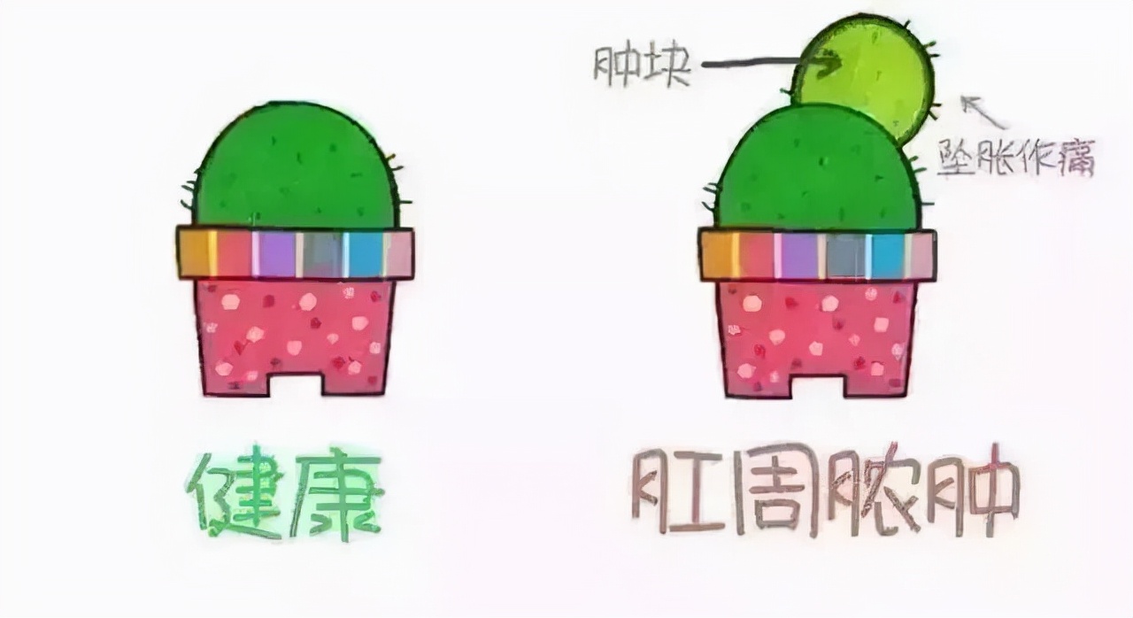 直肠-肛管良性疾病都需要手术治疗吗？