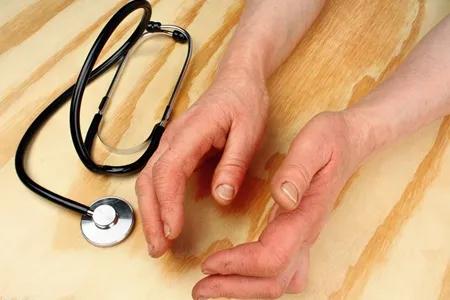 手指风湿性关节炎症状和治疗方法,风湿性关节炎症状和治疗方法成都