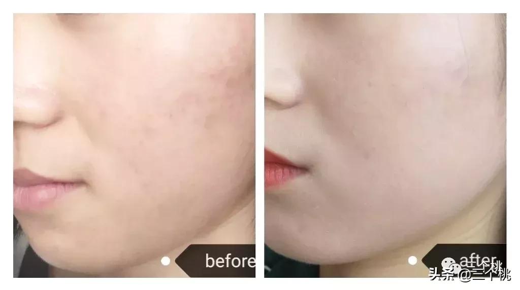 十大公认好用的粉底液评测,十大口碑最好的粉底液夏天