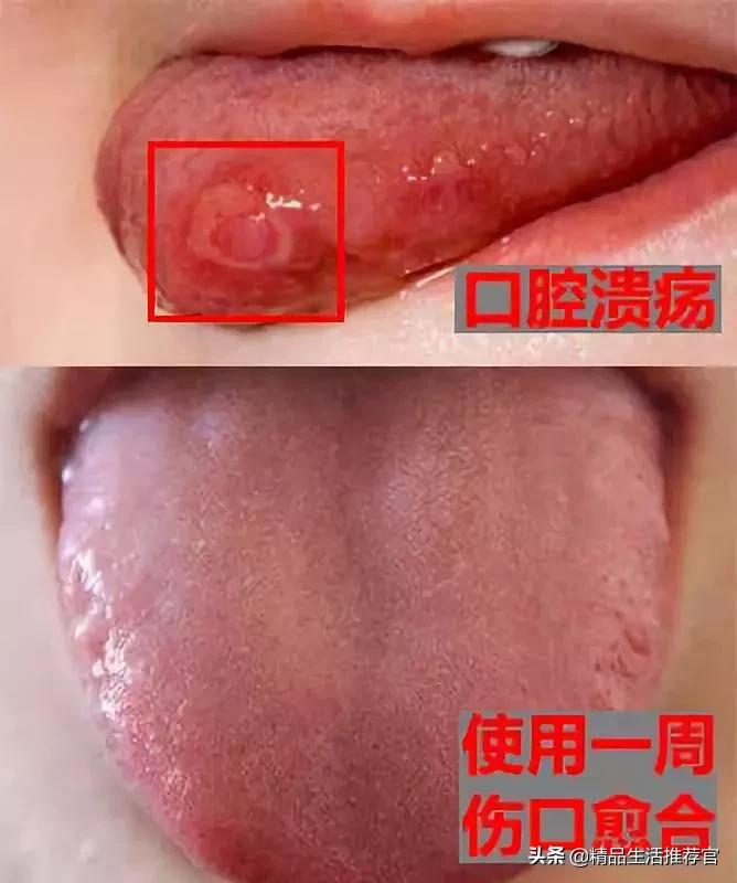 牙黄口臭一招搞定,美白牙齿最有效的方法洗牙