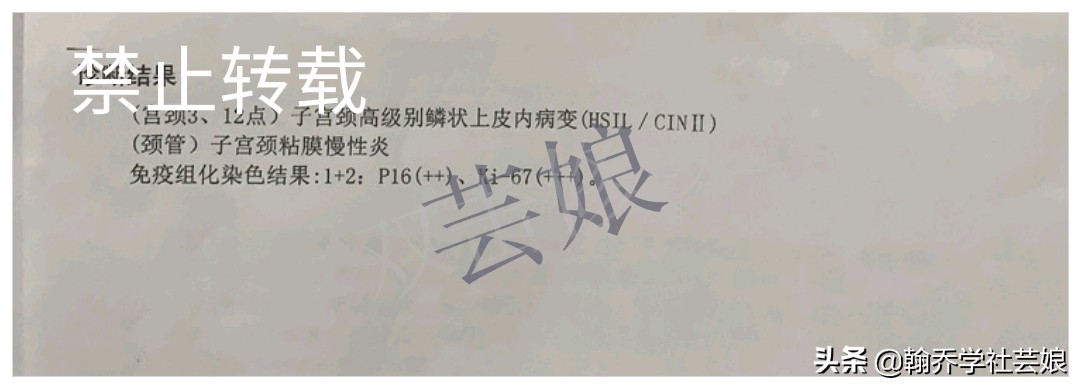 cin2治愈可以买保险吗,刚确诊cin1级可以买什么保险