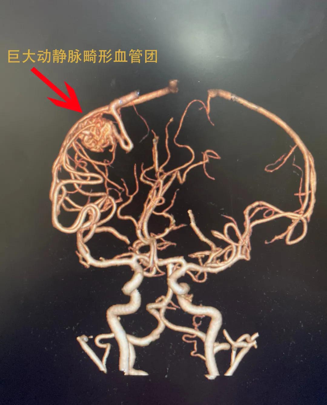 普洱市人民医院神经内科,思茅区人民医院神经外科