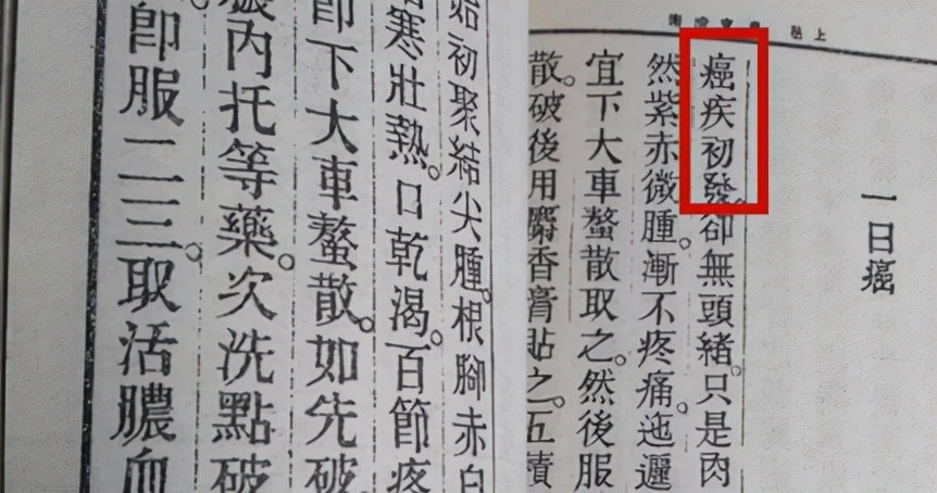 化疗反应重怎么处理,化疗反应大是怎么处理