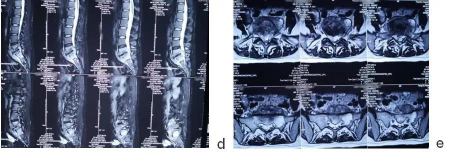 唐都医院脊柱科廖博,脊柱外科医生廖博